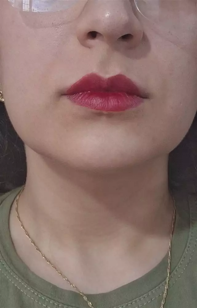 نتیجه مصرف تینت لب