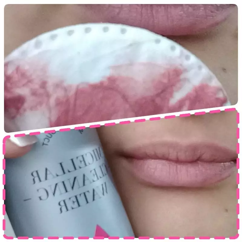 نتیجه مصرف میسلار واتر