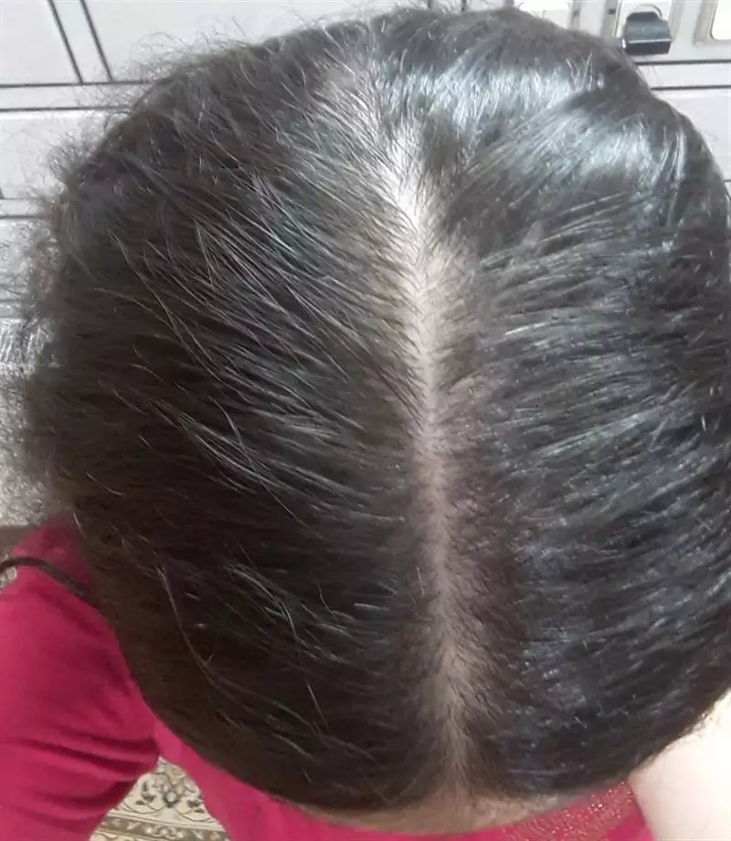 نتیجه مصرف روغن ترکیبی مو