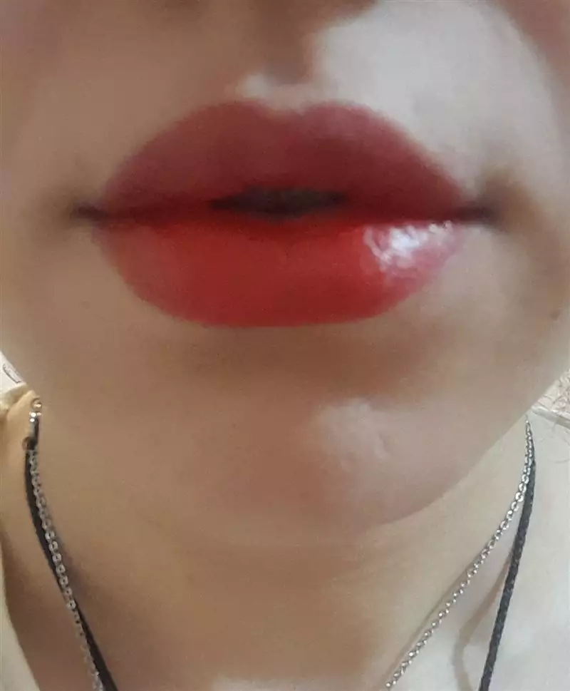 نتیجه مصرف تینت لب