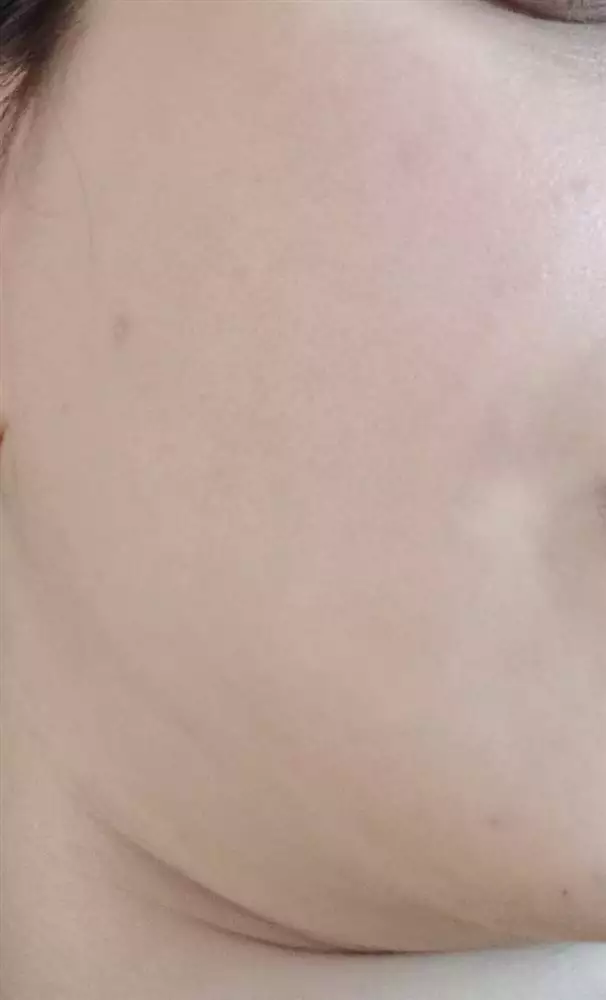 نتیجه مصرف ژل تقویتی آلوئه ورا