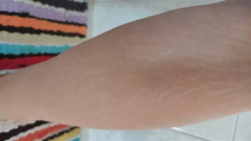 نتیجه مصرف پک مراقبتی ترک پوستی