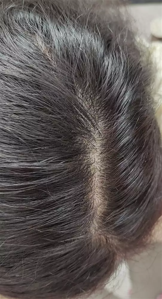 نتیجه مصرف شامپو موی چرب رپ رپ