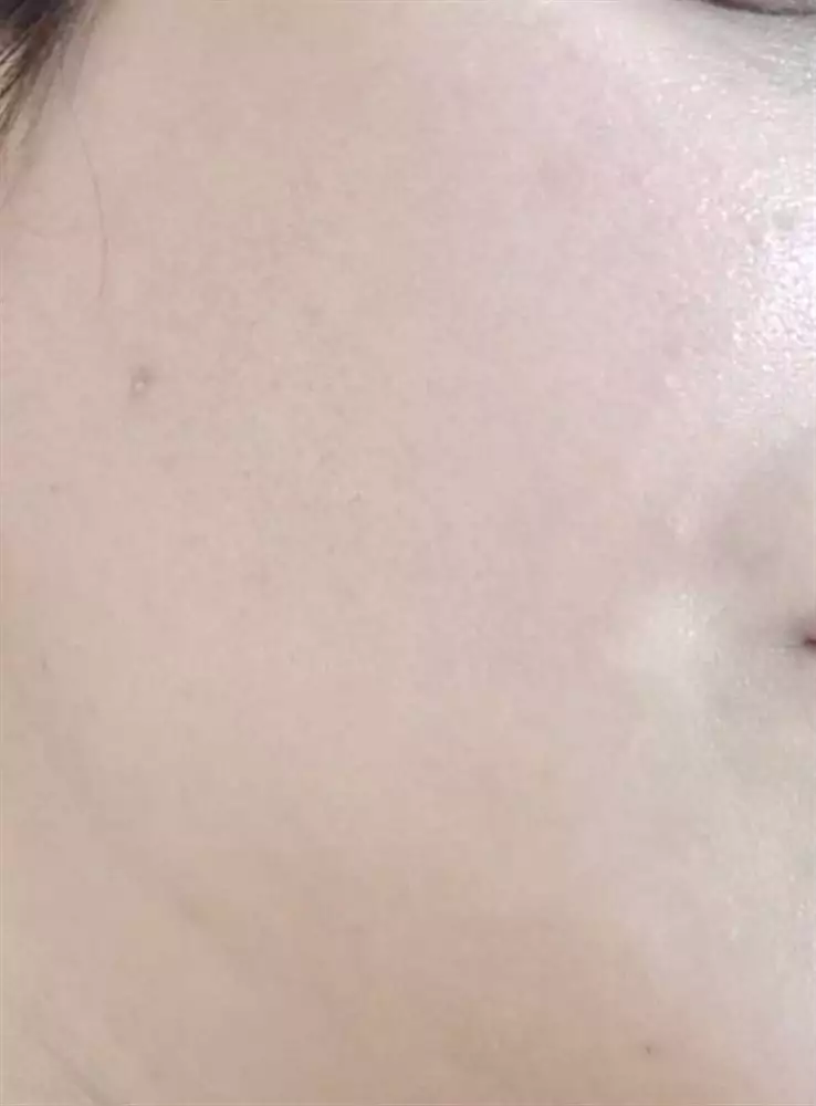 نتیجه مصرف صابون زردچوبه