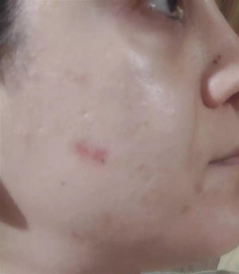 نتیجه مصرف ژل مغذی پوست اسپیرولینا