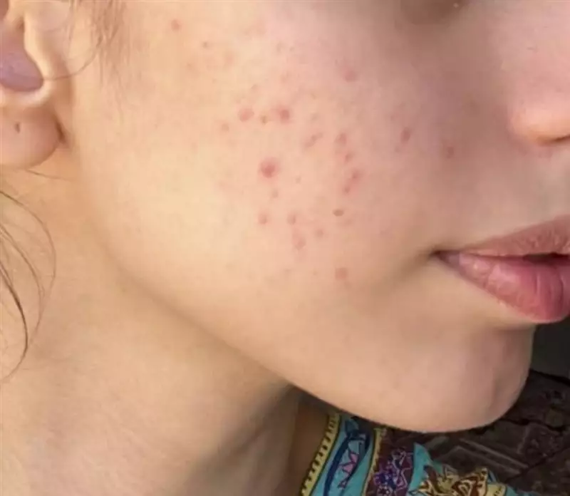 نتیجه مصرف صابون زردچوبه