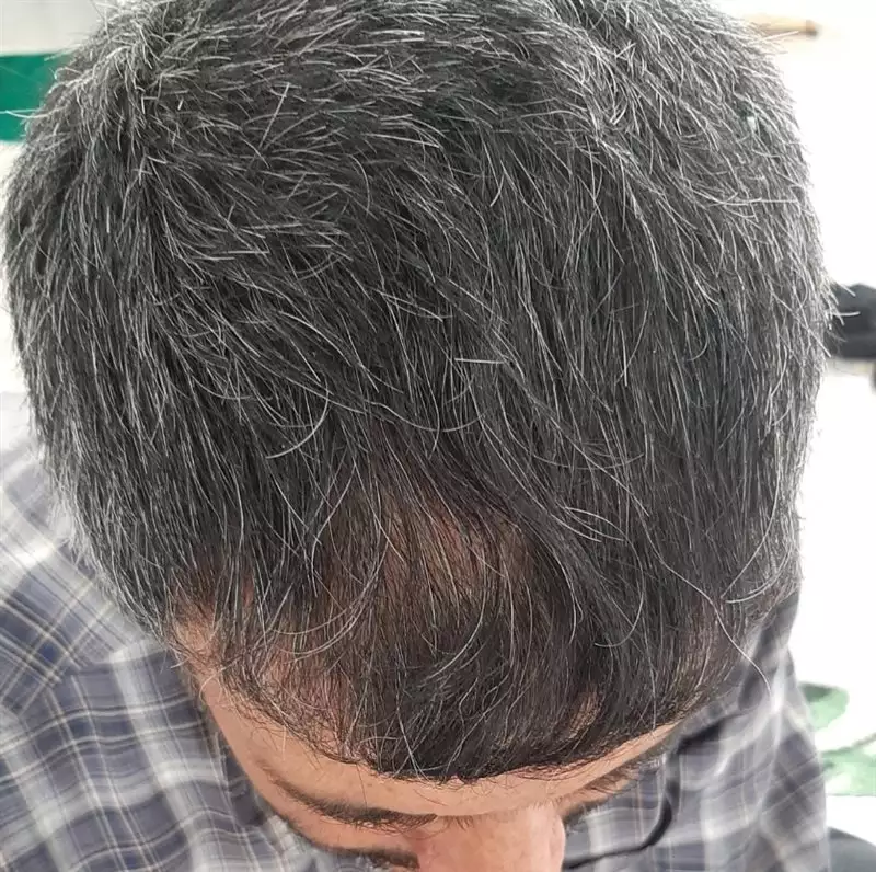 نتیجه مصرف روغن ترکیبی مو