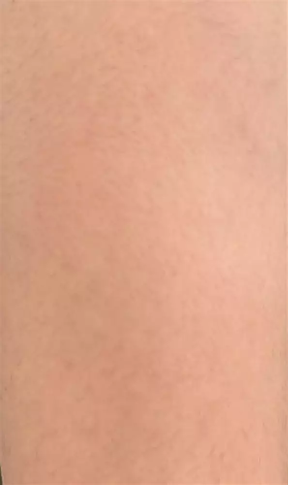 نتیجه مصرف روغن آرگان