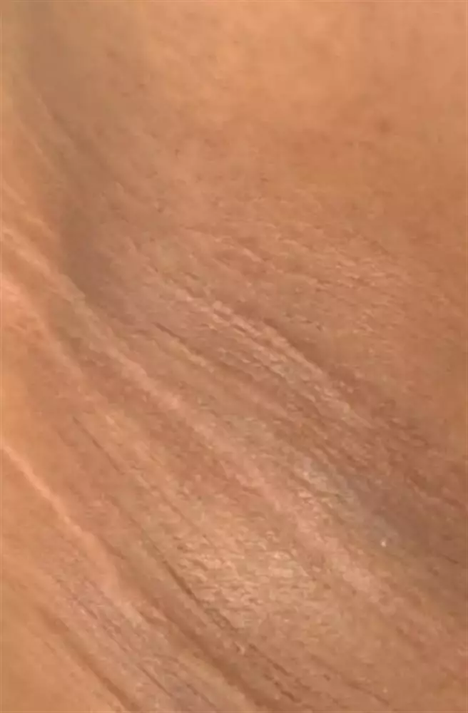 نتیجه مصرف ژل اسکراب رفع تیرگی پوست