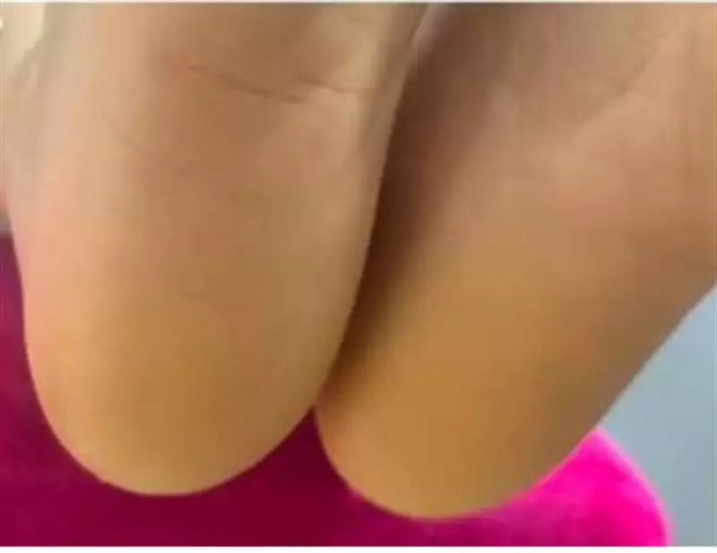 نتیجه مصرف شی باتر