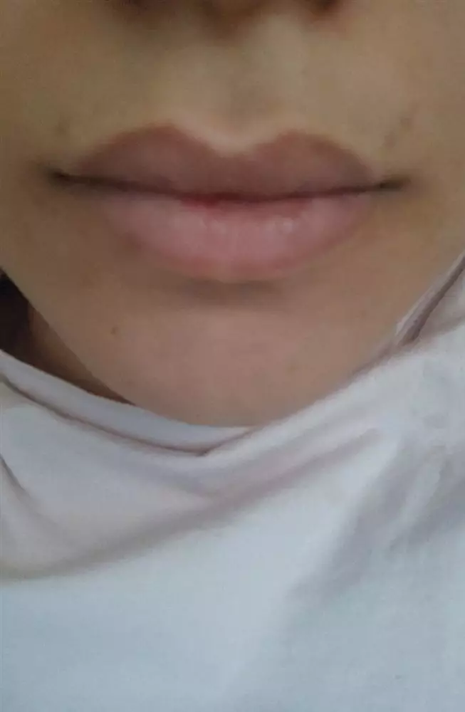 نتیجه مصرف شی باتر