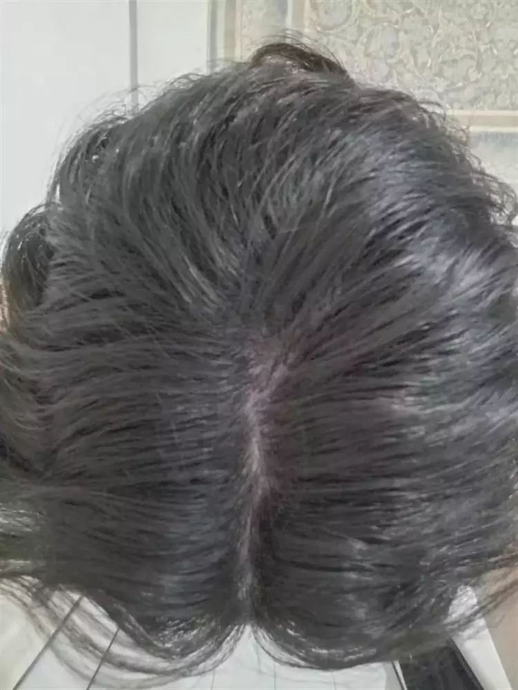 نتیجه مصرف تونیک ضد ریزش و تقویتی مو