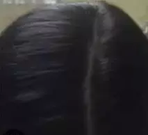 نتیجه مصرف تونیک ضد ریزش و تقویتی مو