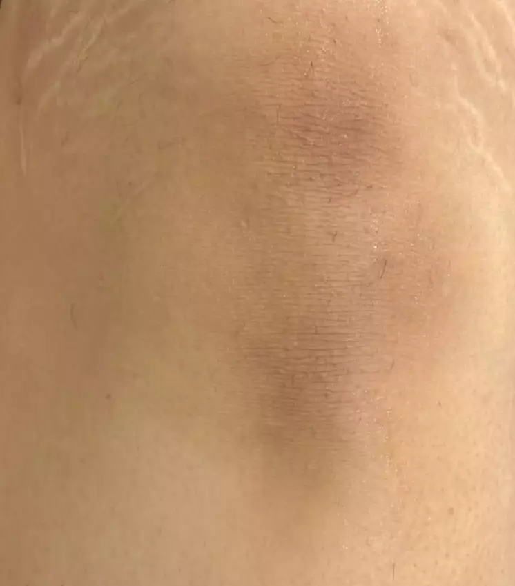 نتیجه مصرف ژل اسکراب رفع تیرگی پوست