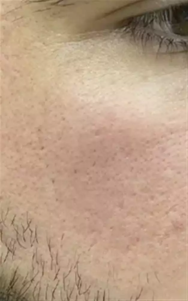 نتیجه مصرف خاک رس سفید