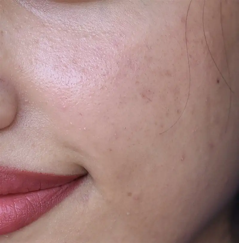 نتیجه مصرف صابون برنج ژاپنی