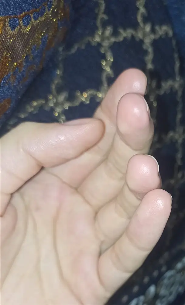 نتیجه مصرف شی باتر