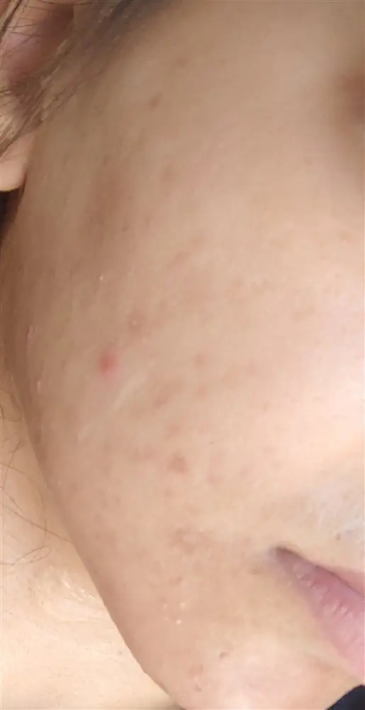 نتیجه مصرف صابون برنج ژاپنی