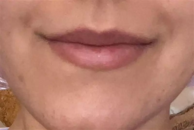 نتیجه مصرف تینت لب