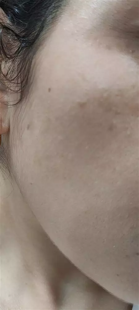 نتیجه مصرف صابون برنج ژاپنی