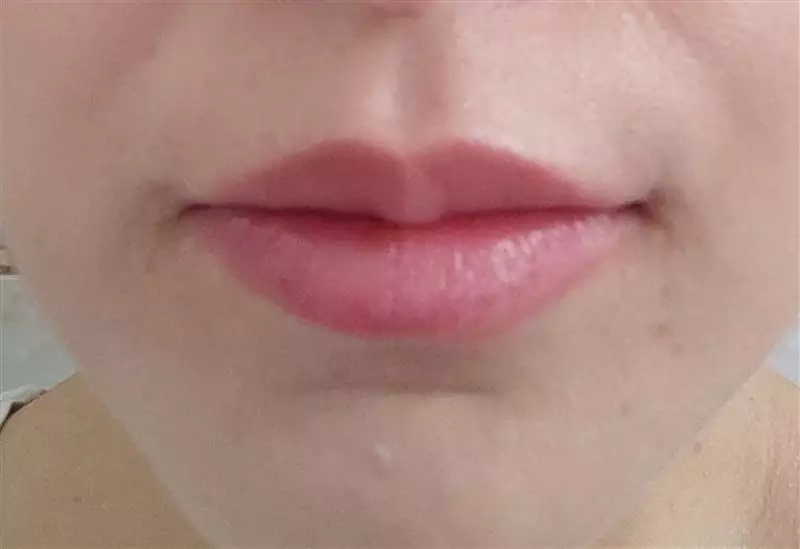 نتیجه مصرف تینت لب