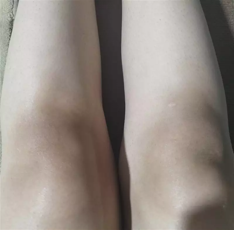 نتیجه مصرف ژل اسکراب رفع تیرگی پوست