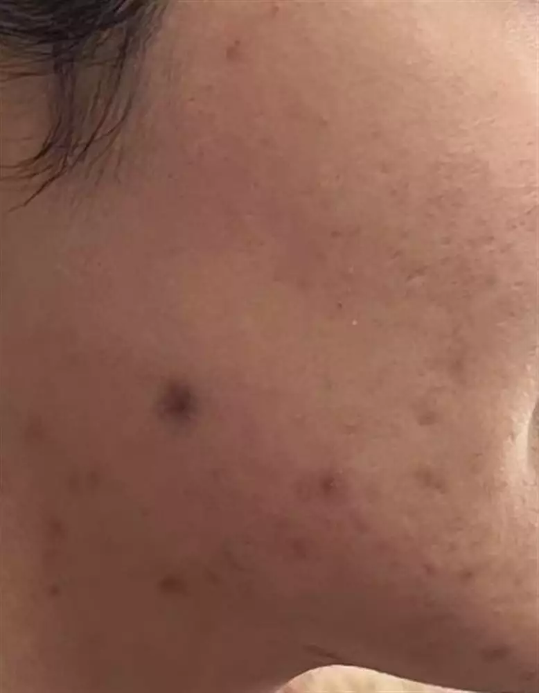 نتیجه مصرف صابون زردچوبه