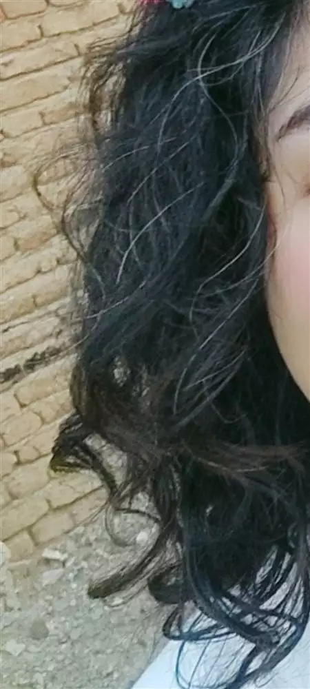 نتیجه مصرف روغن بادام شیرین