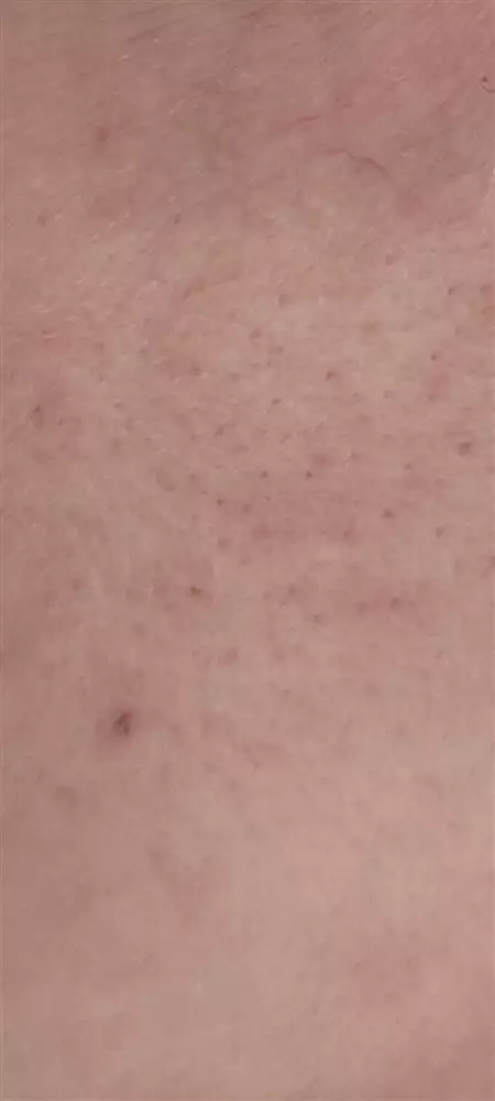 نتیجه مصرف روغن گل سرخ