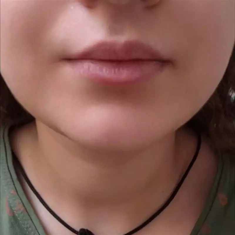 نتیجه مصرف تینت لب