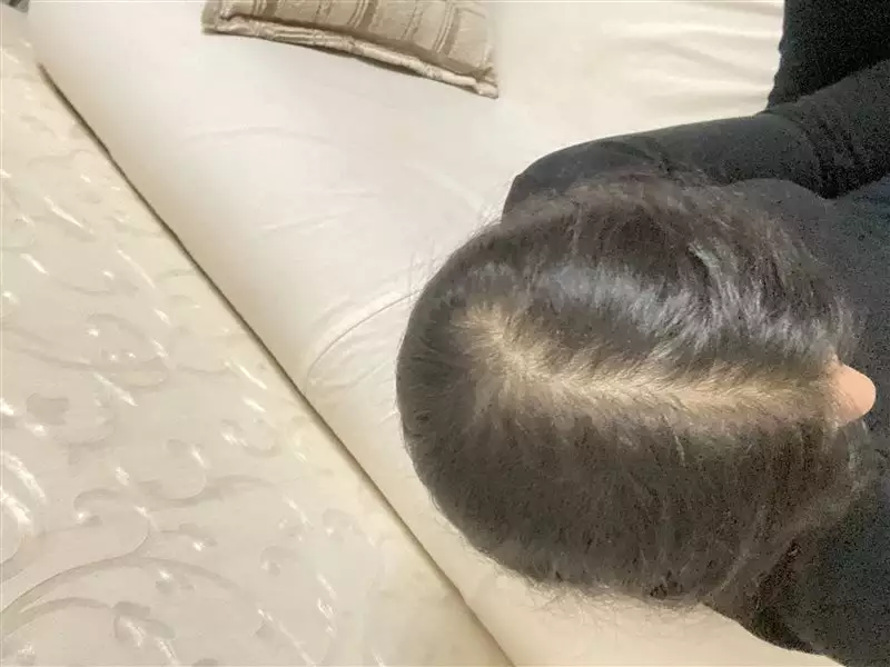 نتیجه مصرف تونیک ضد ریزش و تقویتی مو