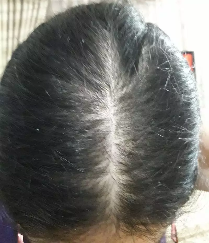 نتیجه مصرف روغن ترکیبی مو