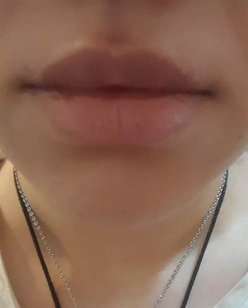 نتیجه مصرف تینت لب