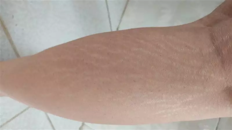 نتیجه مصرف پک مراقبتی ترک پوستی