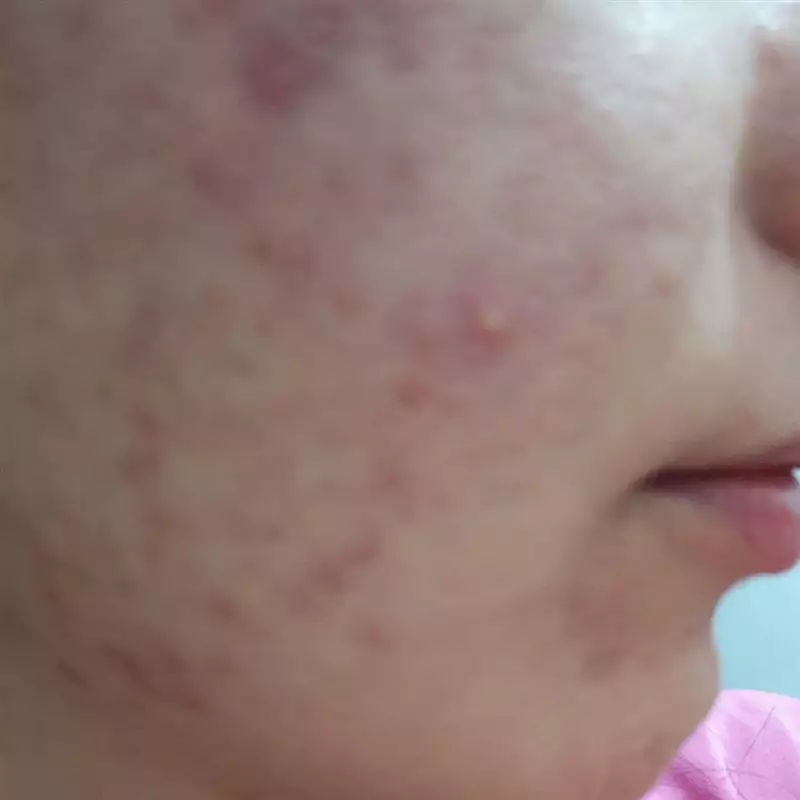 نتیجه مصرف ژل تقویتی آلوئه ورا