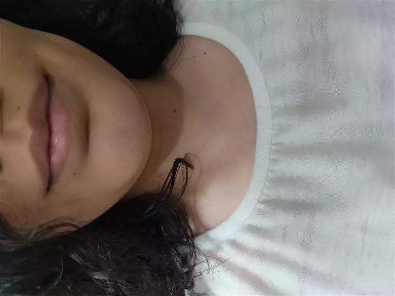 نتیجه مصرف تینت لب