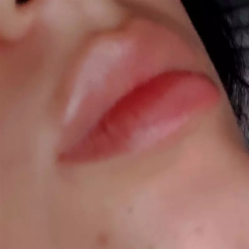 نتیجه مصرف تینت لب