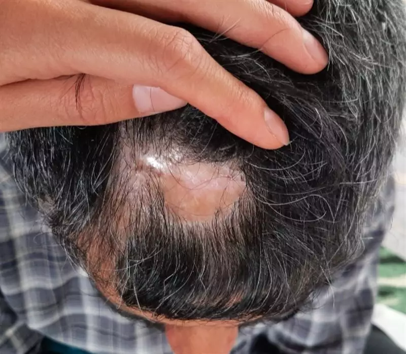 نتیجه مصرف روغن ترکیبی مو