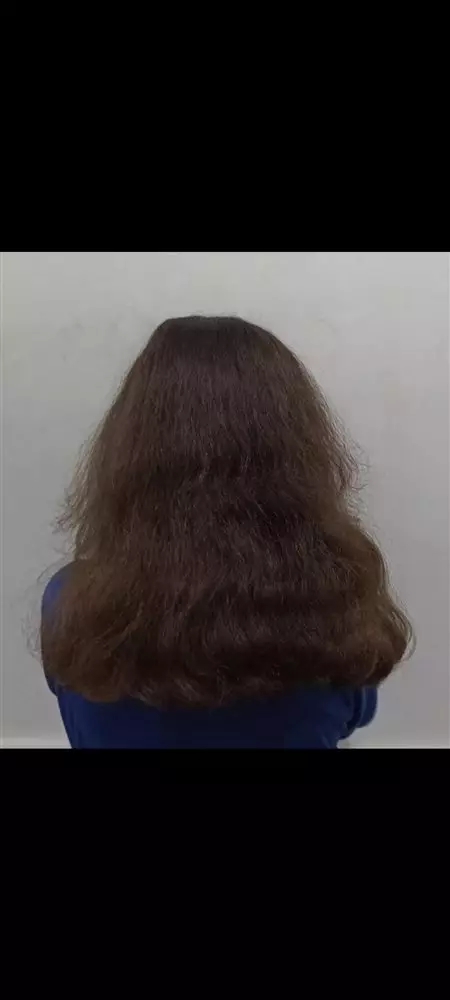 نتیجه مصرف ژل مغذی پوست اسپیرولینا