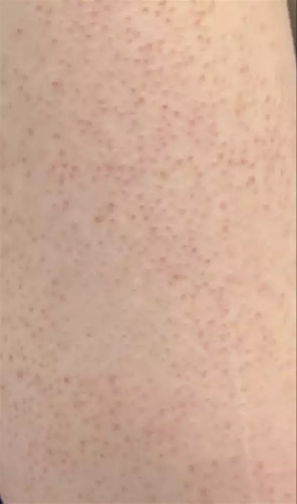 نتیجه مصرف روغن آرگان