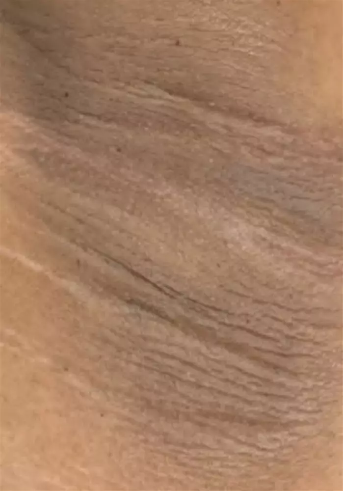 نتیجه مصرف ژل اسکراب رفع تیرگی پوست