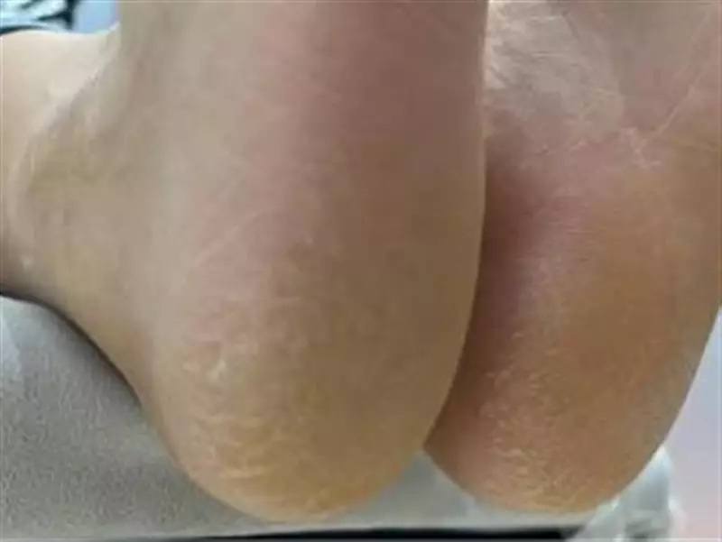 نتیجه مصرف شی باتر