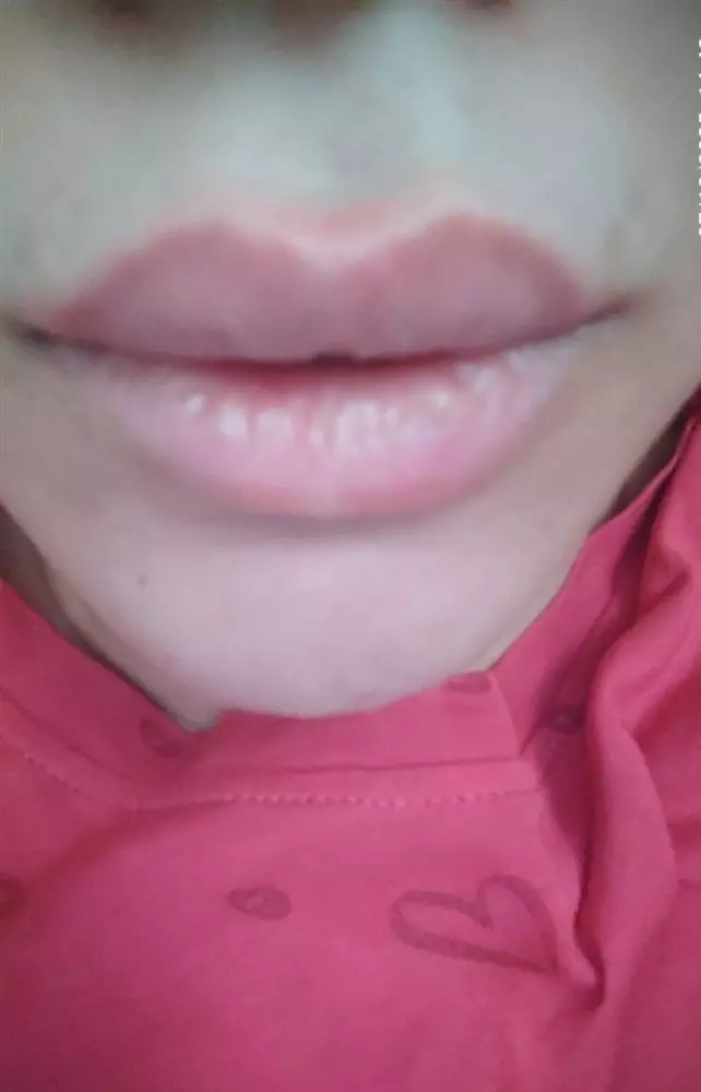 نتیجه مصرف شی باتر