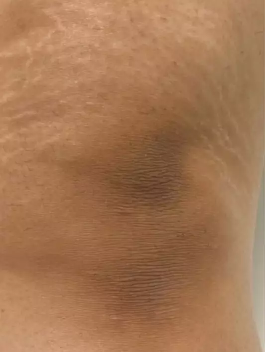 نتیجه مصرف ژل اسکراب رفع تیرگی پوست