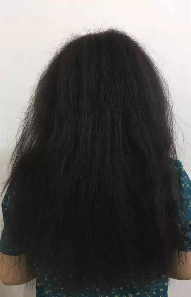 نتیجه مصرف اسپری ده در یک