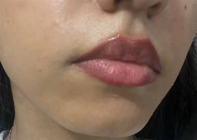 نتیجه مصرف میسلار واتر