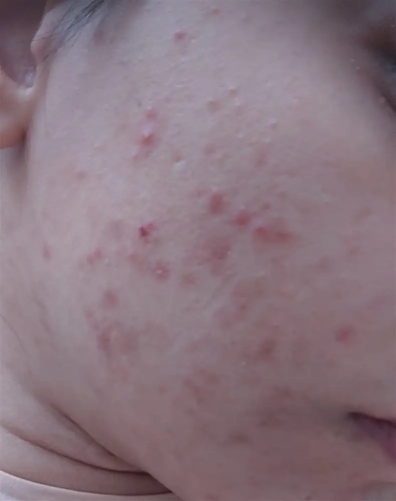 نتیجه مصرف صابون برنج ژاپنی
