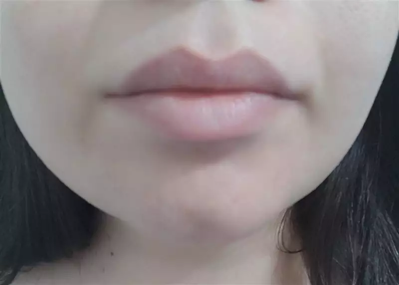 نتیجه مصرف تینت لب