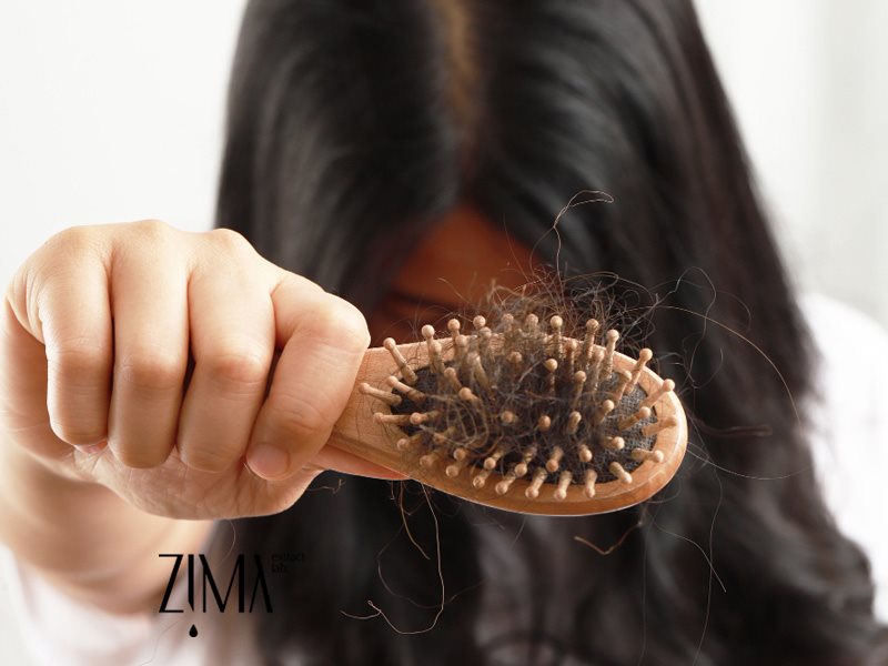 ریزش موی زنان