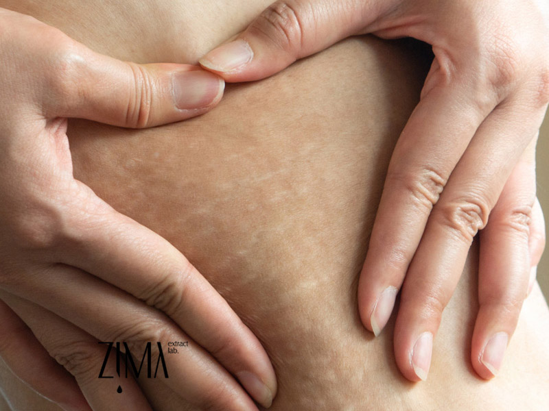 محو کردن ترک پوستی با روغن آرگان